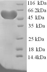 Greater than 90% as determined by SDS-PAGE.Recombinant Rat Hemopexin (HPX) Protein (His)