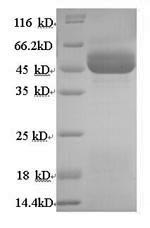 Greater than 90% as determined by SDS-PAGE.Recombinant Human 11-Beta-Hydroxysteroid Dehydrogenase Type 2 (HSD11B2) Protein (His)