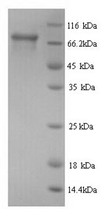 Greater than 90% as determined by SDS-PAGE.Recombinant Human Peroxisomal Multifunctional Enzyme Type 2 (HSD17B4) Protein (His)