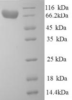 Greater than 90% as determined by SDS-PAGE.Recombinant Human Alpha-L-Iduronidase (IDUA) Protein (His)