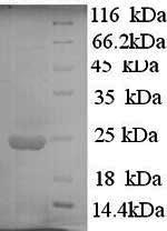 Greater than 90% as determined by SDS-PAGE.Recombinant Human Interferon Alpha-10 (IFNA10) Protein (His)