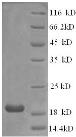 Greater than 90% as determined by SDS-PAGE.Recombinant Human Interferon Alpha-21 (IFNA21) Protein (His)