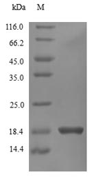 Greater than 90% as determined by SDS-PAGE.Recombinant Human Interferon Gamma (IFNG) Protein (His)