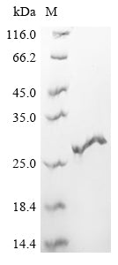 Greater than 90% as determined by SDS-PAGE.Recombinant Cynomolgus Monkey Interferon Gamma (IFNG) Protein (His)
