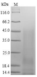 Greater than 90% as determined by SDS-PAGE.Recombinant Mouse Immunoglobulin J Chain (JCHAIN) Protein (His)