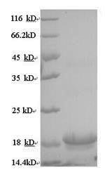 Greater than 90% as determined by SDS-PAGE.