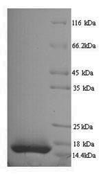 Greater than 90% as determined by SDS-PAGE.Recombinant Rhesus Macaque Interleukin-15 (IL15) Protein (His)