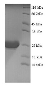 Greater than 90% as determined by SDS-PAGE.