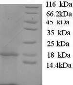 Greater than 90% as determined by SDS-PAGE.Recombinant Sheep Interleukin-1 Beta (IL1B) Protein (His)