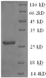 Greater than 90% as determined by SDS-PAGE.Recombinant Mouse Interleukin-2 Receptor Subunit Beta (IL2RB) Protein (His)