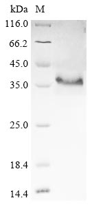 Greater than 85% as determined by SDS-PAGE.