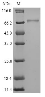 Greater than 85% as determined by SDS-PAGE.Recombinant Mouse Isthmin-1 (ISM1)