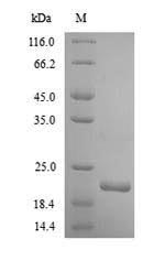 Greater than 90% as determined by SDS-PAGE.Recombinant Human Integrin Alpha-2 (ITGA2) Protein (His)