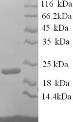 Greater than 90% as determined by SDS-PAGE.Recombinant Mouse Integrin Alpha-L (ITGAL) Protein (His)