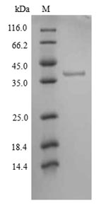 Greater than 90% as determined by SDS-PAGE.Recombinant Human Tyrosine-Protein Kinase Jak1 (JAK1) Protein (His)