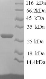 Greater than 90% as determined by SDS-PAGE.Recombinant Human Junctional Adhesion Molecule B (JAM2) Protein (His)
