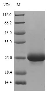 Greater than 90% as determined by SDS-PAGE.Recombinant Human Atp-Sensitive Inward Rectifier Potassium Channel 1 (KCNJ1) Protein (His)