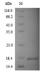 Greater than 90% as determined by SDS-PAGE.Recombinant Human Potassium Channel Subfamily K Member 2 (KCNK2) Protein (His/Tag-Free)