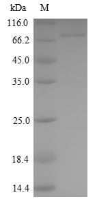 Greater than 90% as determined by SDS-PAGE.Recombinant Human Kelch-Like Ech-Associated Protein 1 (KEAP1) Protein (His)