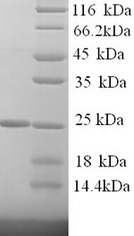Greater than 90% as determined by SDS-PAGE.Recombinant Human Kallikrein-7 (KLK7) Protein (His)