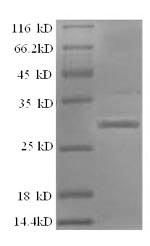 Greater than 90% as determined by SDS-PAGE.Recombinant Rat Plasma Kallikrein (KLKB1) Protein (His)