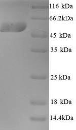 Greater than 90% as determined by SDS-PAGE.Recombinant Human Kynurenine 3-Monooxygenase (KMO) Protein (His)