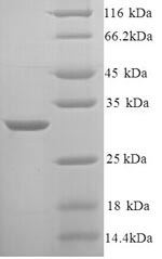 Greater than 90% as determined by SDS-PAGE.Recombinant Rat Kininogen-1 (KNG1) Protein (His)