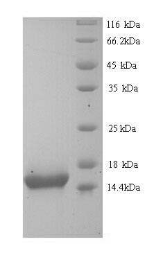 Greater than 90% as determined by SDS-PAGE.Recombinant Human Keratin, Type I Cytoskeletal 10 (KRT10) Protein (His)