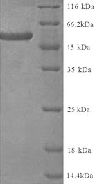 Greater than 90% as determined by SDS-PAGE.Recombinant Human Keratin, Type Ii Cytoskeletal 4 (KRT4) Protein (His)