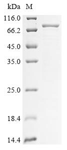 Greater than 85% as determined by SDS-PAGE.Recombinant Human Keratin, Type Ii Cuticular Hb5 (KRT85) Protein (His)