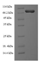 Greater than 90% as determined by SDS-PAGE.Recombinant Human Plastin-2 (LCP1) Protein (His)