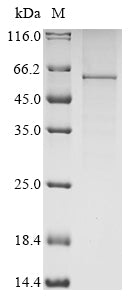 Greater than 90% as determined by SDS-PAGE.Recombinant Human Leucine-Rich Glioma-Inactivated Protein 1 (LGI1) Protein (His-PDI)