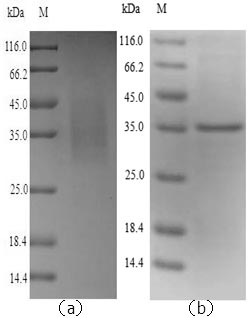 Greater than 90% as determined by SDS-PAGE.Recombinant Mouse Legumain (LGMN) Protein (His)