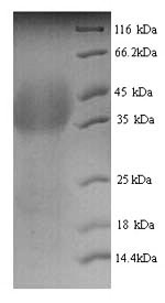 Greater than 90% as determined by SDS-PAGE.Recombinant Human Lutropin-Choriogonadotropic Hormone Receptor (LHCGR) Protein (His)