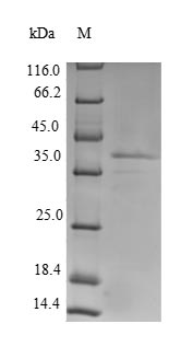 Greater than 90% as determined by SDS-PAGE.Recombinant Rat Lutropin-Choriogonadotropic Hormone Receptor (LHCGR) Protein (His)