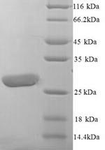 Greater than 90% as determined by SDS-PAGE.Recombinant Human Leukocyte Immunoglobulin-Like Receptor Subfamily A Member 5 (LILRA5) Protein (His)