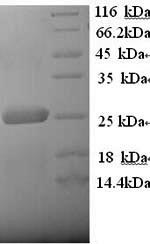 Greater than 90% as determined by SDS-PAGE.Recombinant Human Low-Density Lipoprotein Receptor-Related Protein 2 (LRP2) Protein (His)