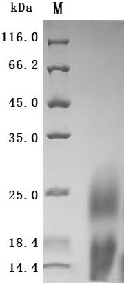 Greater than 95% as determined by SDS-PAGE.Recombinant Human Lymphocyte Antigen 6 Complex Locus Protein G6D (LY6G6D) Protein (His), Active