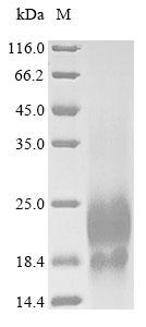 Greater than 90% as determined by SDS-PAGE.Recombinant Human Lymphocyte Antigen 6 Complex Locus Protein G6D (LY6G6D) Protein (His)