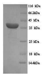 Greater than 90% as determined by SDS-PAGE.Recombinant Human Melanoma-Associated Antigen 1 (MAGEA1) Protein (His)