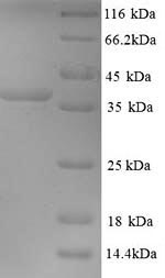 Greater than 90% as determined by SDS-PAGE.Recombinant Mouse Microtubule-Associated Protein 2 (MAP2) Protein (His)