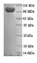 Greater than 90% as determined by SDS-PAGE.Recombinant Human Mannan-Binding Lectin Serine Protease 1 (MASP1) Protein (His)
