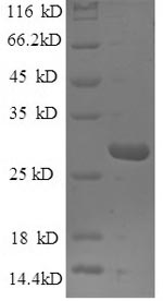 Greater than 90% as determined by SDS-PAGE.Recombinant Human Mannose-Binding Protein C (MBL2) Protein (His)