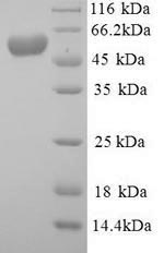 Greater than 90% as determined by SDS-PAGE.Recombinant Mouse E3 Ubiquitin-Protein Ligase Mdm2 (MDM2) Protein (His)