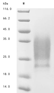 Greater than 90% as determined by SDS-PAGE.Recombinant Human Homeobox Protein Meis1 (MEIS1) Protein (His)
