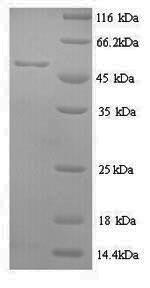 Greater than 90% as determined by SDS-PAGE.Recombinant Human Methionine Aminopeptidase 2 (METAP2) Protein (His)