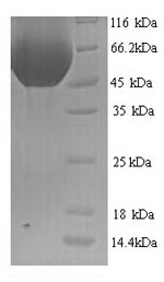 Greater than 90% as determined by SDS-PAGE.Recombinant Rat Multiple Inositol Polyphosphate Phosphatase 1 (MINPP1) Protein (His)
