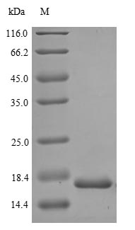 Greater than 90% as determined by SDS-PAGE.Recombinant Human Proliferation Marker Protein Ki-67 (MKI67) Protein (His)