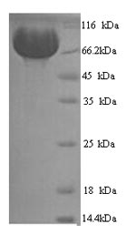 Greater than 90% as determined by SDS-PAGE.Recombinant Human Neprilysin (MME) Protein (His)