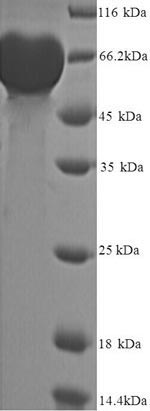 Greater than 90% as determined by SDS-PAGE.Recombinant Human Matrix Metalloproteinase-9 (MMP9) Protein (His)